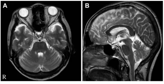 Fig. 2 Neck and chest CT scans.