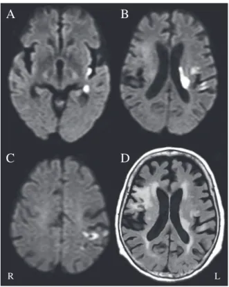 Fig. 1 MRI study 5 days after onset.