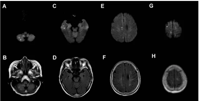 Fig. 2 Brain MRI findings at the second admission (September, 2013).