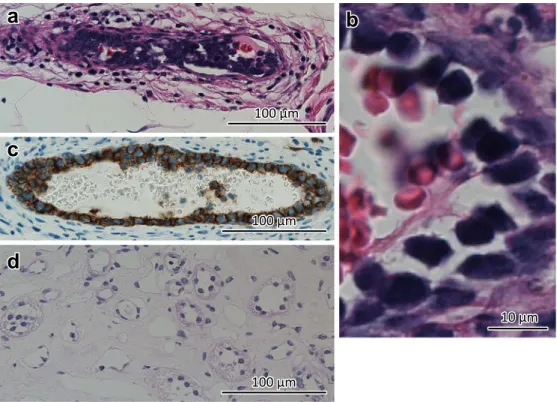Fig. 2 Pathological result of a random skin biopsy (a–c) and left renal biopsy (d).