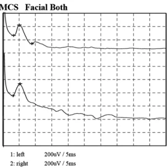 Fig. 3 Electrophysiological findings.