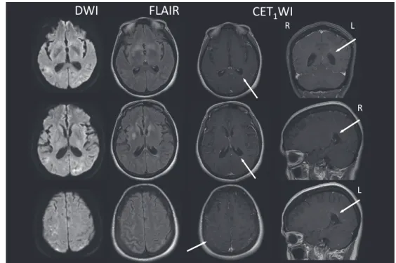 Fig. 1 Cranial MRI on admission.