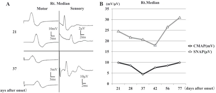 Fig. 1 Findings of the nerve conduction study (NCS) (A, B).