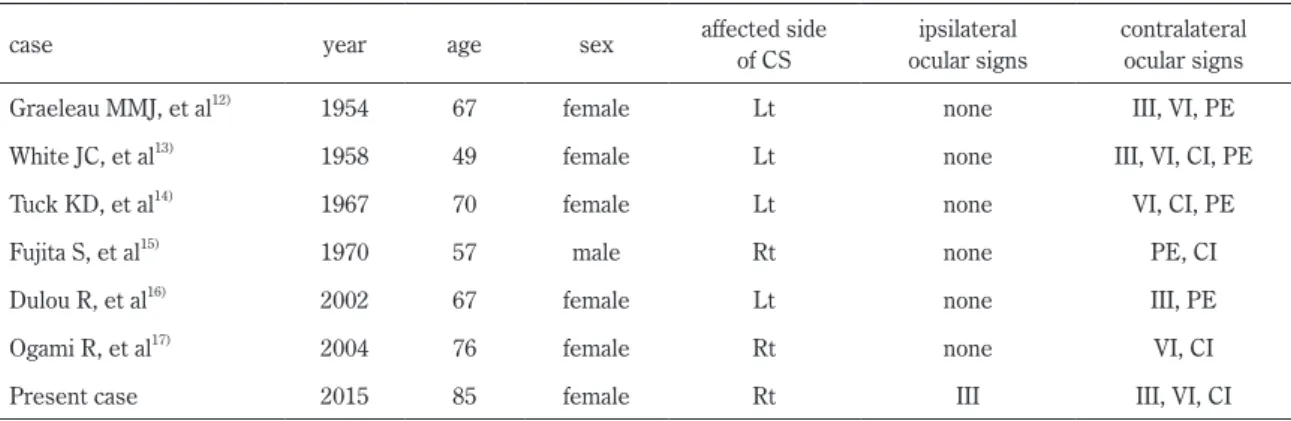 Table 1  Summary of reported dural arteriovenous fistula of cavernous sinus with contralateral ocular signs.