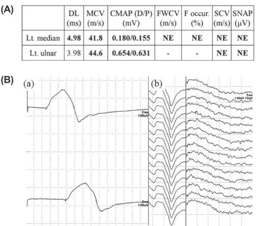 Fig. 3 Nerve conduction studies.