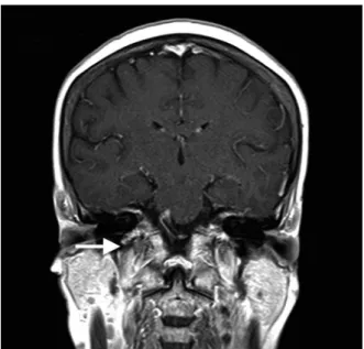 Fig. 2 Clinical course of the patient.