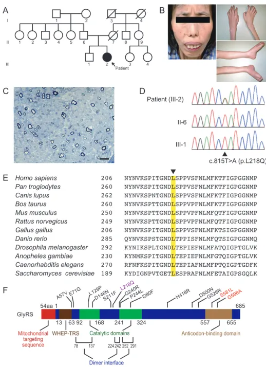 Fig. 1　Clinical, pathological and molecular features of the patient.