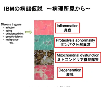Fig. 1 sIBM の病態仮説．