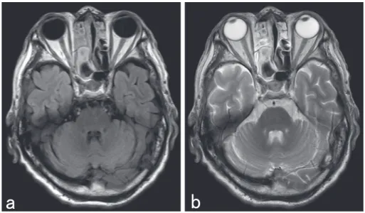 Fig. 2 Brain MRI on admission.