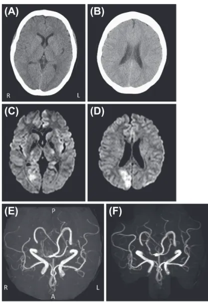 Fig. 1 CT and MR images