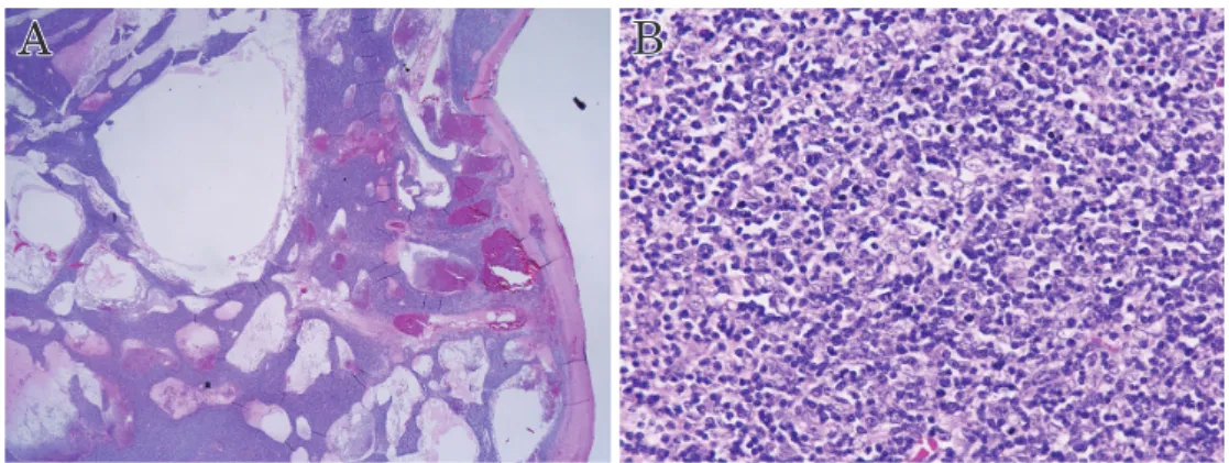 Fig. 2 Microscopic findings of the thymoma.