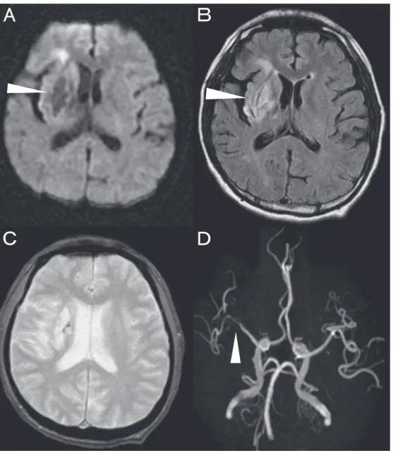 Fig. 1 Magnetic resonance imaging/angiography.