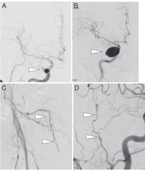 Fig. 2 Cranial angiography.