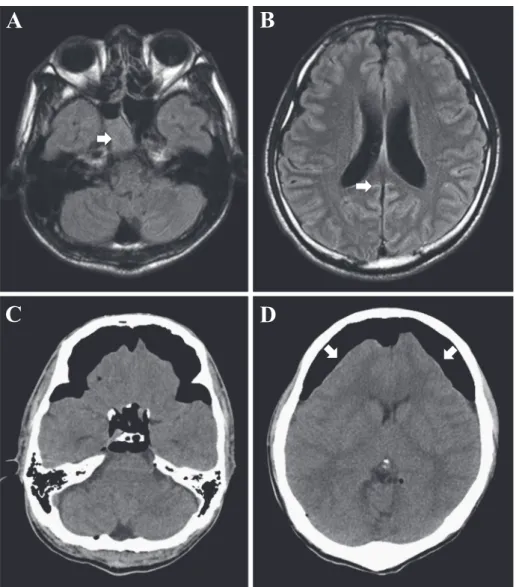 Fig. 1 Brain MRI and CT findings.