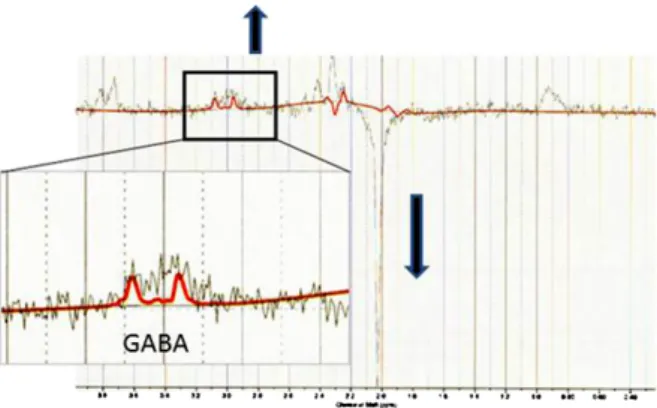Fig. 1 GABA signal observed by MEGA-PRESS.