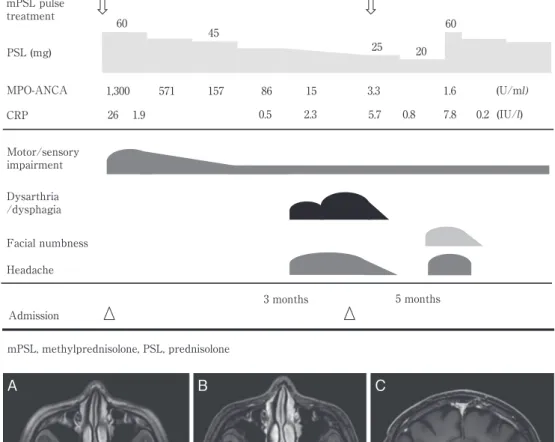 Fig. 1 Clinical course (upper row); and brain images (lower row), fluid attenuated inversion recov- Fig. 1 Clinical course (upper row); and brain images (lower row), fluid attenuated inversion recov-ery  (FLAIR)  image  (Axial,  3T;  TR  6,000  ms,  TE  32