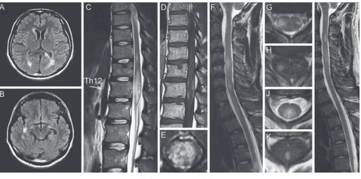Fig. 2 Spinal cord and brain images.