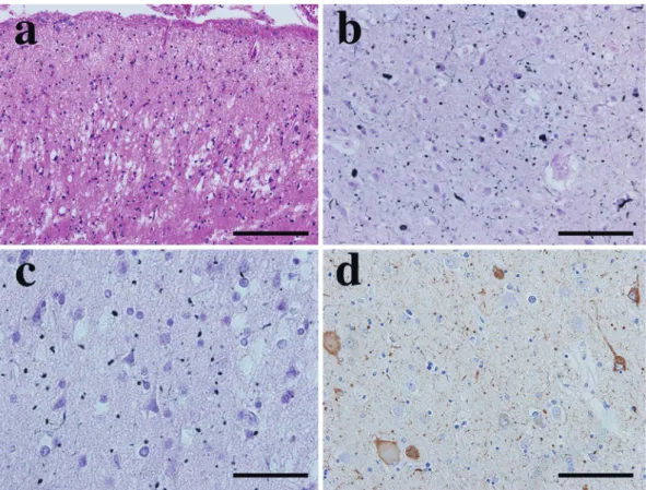 Fig. 3 Representative microscopic images of the limbic lesions.