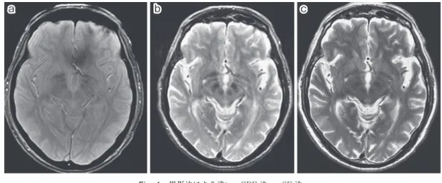 Fig. 1 撮影法による違い―GRE 法 vs. SE 法．