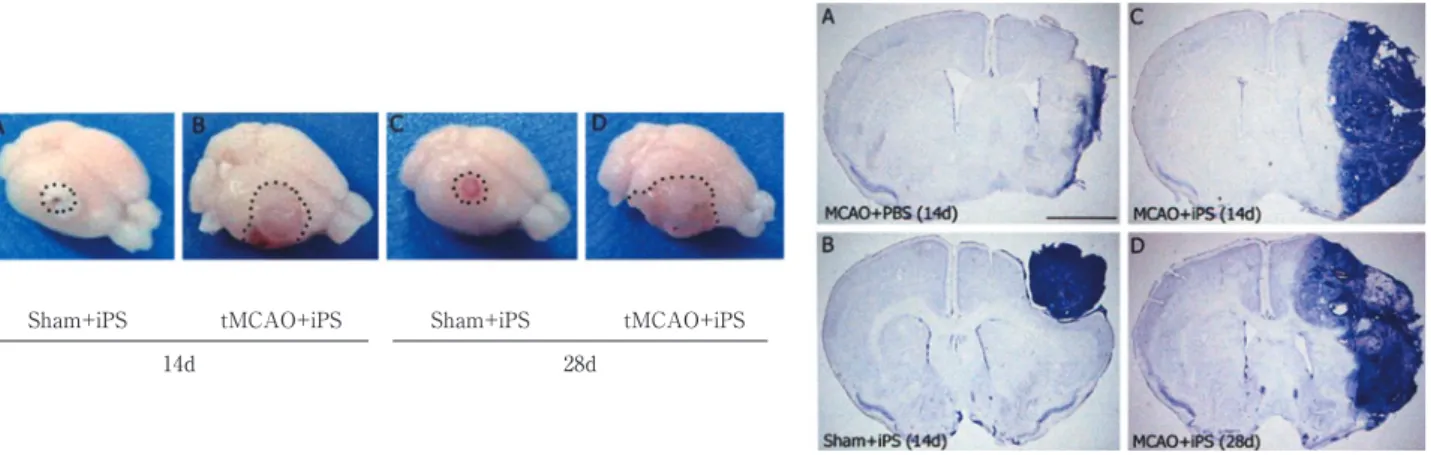 Fig. 1 Sham  control 脳（Sham）に移植した場合とくらべて，一過性脳虚血（tMCAO）後の脳に 移植した iPS 細胞は，14 日目および 28 日目に大きく腫瘍化した（左）．同脳の切片染色では，小 さく境界明瞭な正常脳移植 iPS 組織とくらべて，巨大化し境界不鮮明な iPS 組織がみとめられた（右）． （Kawai, Yamashita, and Abe, JCBFM, 2010）tMCAO+iPSSham+iPS14d tMCAO+iPSSham+iPS28d Fig. 2 脳梗