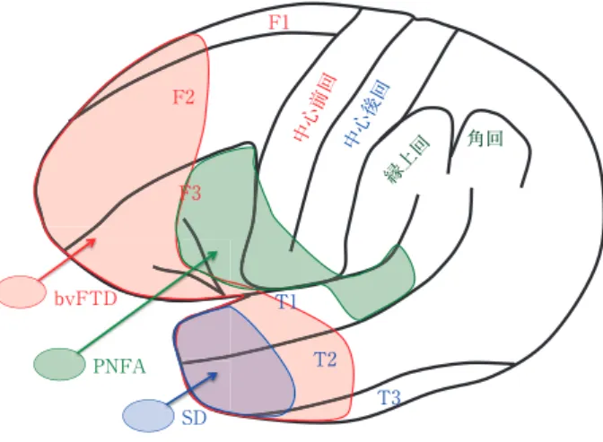Fig. 1 FTLD の変性部位と FTD の臨床亜型．