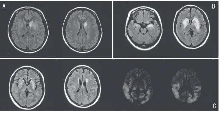 Fig. 1 Brain MR images.