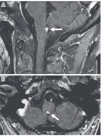 Fig. 1 Brain MRI with contrast medium.