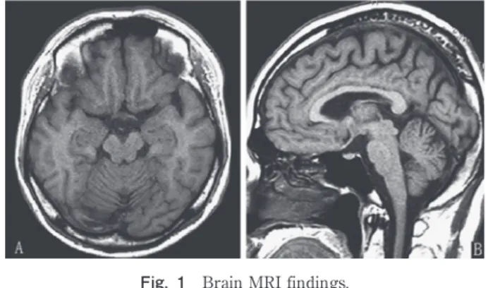 Fig. 1 Brain MRI findings. 
