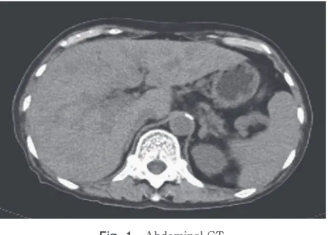 Fig. 1 Abdominal CT.
