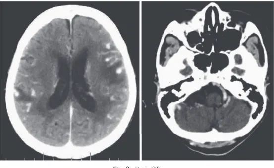 Fig. 2 Brain CT.
