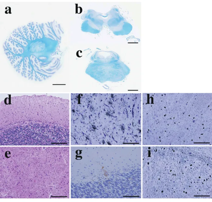 Fig. 2 Neuropathologic findings.