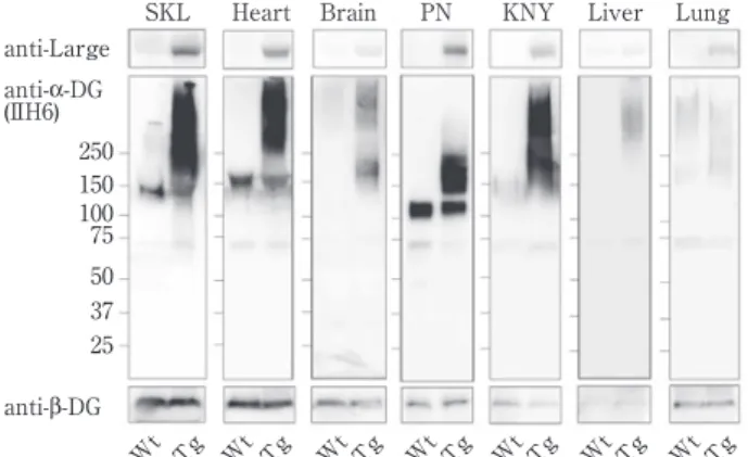 Fig. 2 Several  tissues  of  Large  transgenic  mice  were  examined by Western blotting. Overexpression of Large  was  confirmed  in  these  tissues.  Intense  bands  of  α-dystroglycan  with  broader  appearance  and  higher  molecular  mass  were  detec