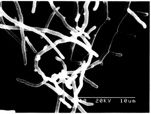 図 5 放線菌 Y M 1‑1 の走査電子顕徴鏡写真 表 2 放線菌 Y M 1‑1 が生産する赤色酵母細胞壁(菌体)分解酵素活性 40% 硫安飽和画分活性 80% 硫安飽和画分活性 基 質 比活性 (Unit/mg タンパク質) 菌 体 ラミナリン 2 7 1  1 1 2  が分かった。酵素を硫安沈殿法により部分精製する ため， 40% と 80% 硫安飽和画分を回収し，赤色酵母 細胞壁とラミナリンに対する分解活性を調べた(表 2  )。細胞壁分解活性は 40% 硫安飽和画分に多く， ラミナリン分解活性
