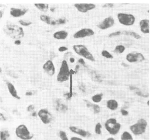 Fig.  1  Focal  necroses  and  inflammatory  cell infiltrations  of  the  liver  (No.  8)
