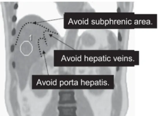 Fig. 1   How to place ROI over the liver.
