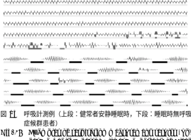 図 14 呼吸計測のための ROI 設定例と呼吸計測例