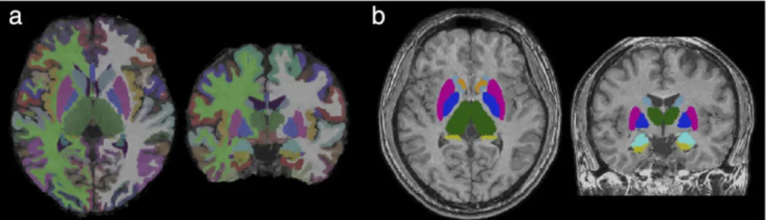 FIGURE 1: Representative labels created from automated parcellation of brain regions using (a) FreeSurfer and (b) FIRST