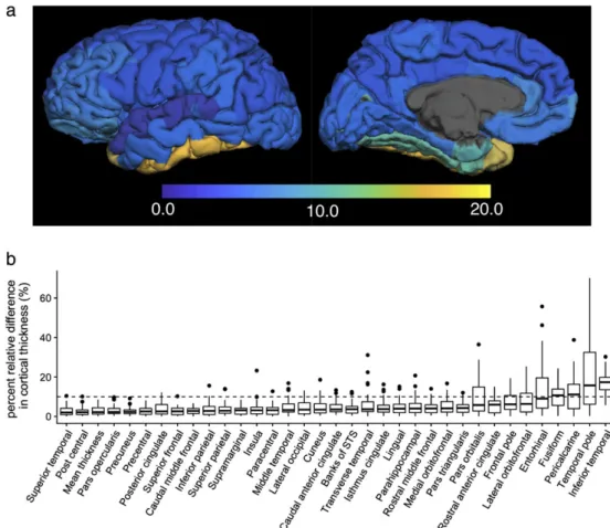 FIGURE 3: Percent relative difference in cortical thickness for 3D-QALAS and FSPGR measured using FreeSurfer