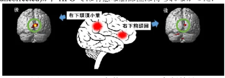 図 1  Open eyes  2 部位による PPI 解析結果  4．時間知覚 BCI の提案    実験結果から得られたことは二つである．一つ目は，これ までの fMRI 計測による時間測定の実験結果では， 3 シチュエ ーションにおいてに共通して rIPL と rIFG に有意な脳活動が 得られた[3]．二つ目は，右 IPL と右 IFG は眼の開閉による差 や機能的結合関係が舌状回によって示唆されたことである． これらのことから次の時間知覚 BCI 案を提案する．オーディ オ機器の音量の調節やリクラ