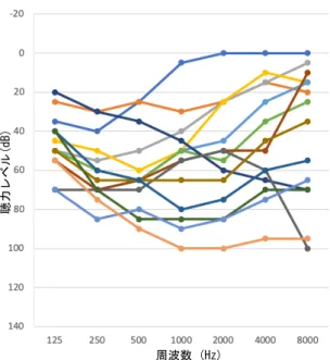 図 8  KCNQ4 遺伝子変異が原因の若年発症型両 側性感音難聴の聴力像  WFS1 遺伝子変異を伴う症例の聴力像  WFS1 遺伝子は、常染色体優性遺伝形式を とる非症候群性難聴のほか Wolfram 症候群 の原因遺伝子として知られる。非症候群性 難聴の場合、発症初期は低音障害型難聴を 呈するが、のちに難聴症状が進行すること が報告されている。本研究で収集された WFS1 遺伝子変異を伴う難聴症例は、そのほ とんどが低音障害型難聴症例であった（図 9） 。  （２）アッシャー症候群の臨床的特徴、お よ