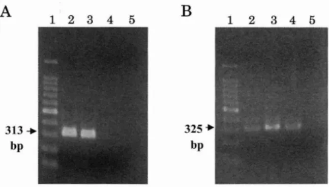 Fig.  2.  PCR  analysis  of  (A)  mecA  gene  and  (B)  b/aZ  gene  in  S.   aureus.  Lane  1,  100-bp  DNA  ladder  (molecular  weight  marker);  lane   2,  S