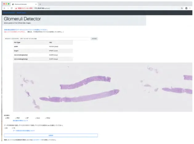 図 8 (a) WEB ブラウザ上でユーザが WSI を選択した後の画面。アップロードする予定 の画像とその染色の種類がチェックされている。 