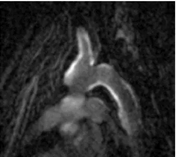 図 2 Gadofluorine Mによるplaque imaging（Schering AG 社提供）
