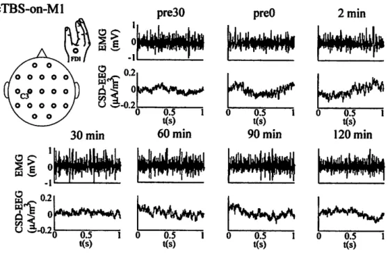 Figure 4.4: 1-second-long segments of raw traces from typical EMG(FDI) and CSD- CSD-transformed EEG(C3) signals recorded from subject 1 in cTBS-on-Ml experiments.