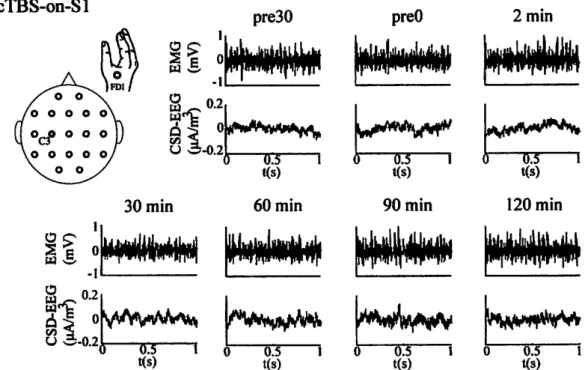 Figure 4.5: 1-second-long segments of raw traces from typical EMG(FDI) and CSD- CSD-transformed EEG(C3) signals recorded from subject 1 in cTBS-on-Sl experiments.