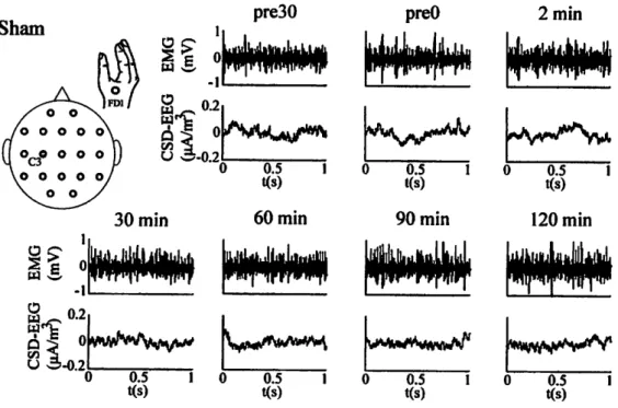 Figure 4.6: 1-second-long segments of raw traces from typical EMG(FDI) and CSD- CSD-transformed EEG(C3) signals recorded from subject 1 in sham experiments.