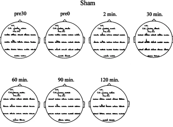 Figure 4.9: Coherence spectra between EEG(19 Channels) and EMG(FDI) signals in sham experiment from Subject 1