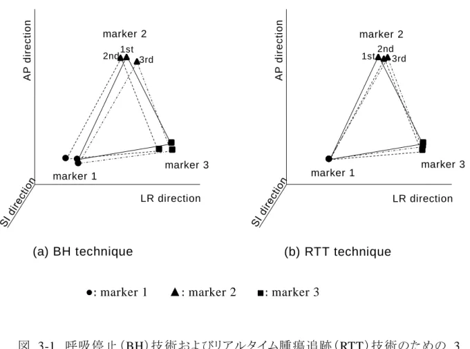 図 3-1  呼吸停止（BH）技術およびリアルタイム腫瘍追跡（RTT ）技術のための 3