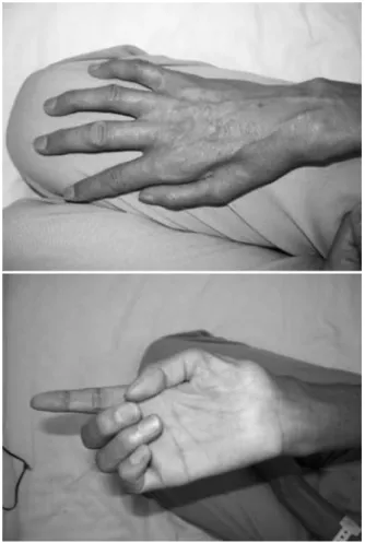 Fig. 1 Photographs of the patientʼs right hand.