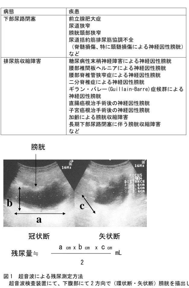 表 1  薬剤により尿閉・排尿困難を起こしやすい下部尿路疾患  病態  疾患  下部尿路閉塞  前立腺肥大症  尿道狭窄  膀胱頸部狭窄  尿道括約筋排尿筋協調不全  （脊髄損傷、特に頸髄損傷による神経因性膀胱） など  排尿筋収縮障害  糖尿病性末梢神経障害による神経因性膀胱  腰部椎間板ヘルニアによる神経因性膀胱  腰部脊椎管狭窄症による神経因性膀胱  二分脊椎症による神経因性膀胱  ギラン・バレー(Guillain-Barre)症候群による 神経因性膀胱  直腸癌根治手術後の神経因性膀胱  子宮癌根治